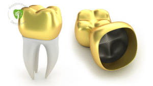 dental crown in Westborough MA