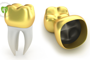 dental crown in Westborough MA