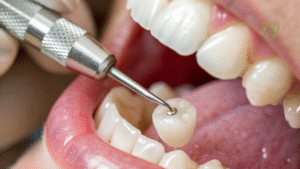 dental crown in Westborough MA