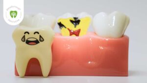 Cracked Tooth Images