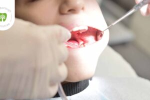 pain relief for braces