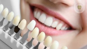 Teeth Whitening